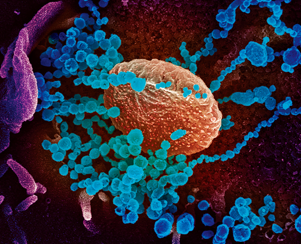 세포(붉은색) 내에서 증식한 뒤 바깥으로 나오는 코로나19(파란색).